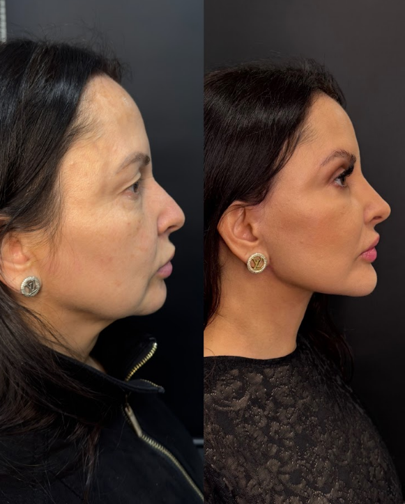 Cirurgias Estéticasda Face & Pálpebras