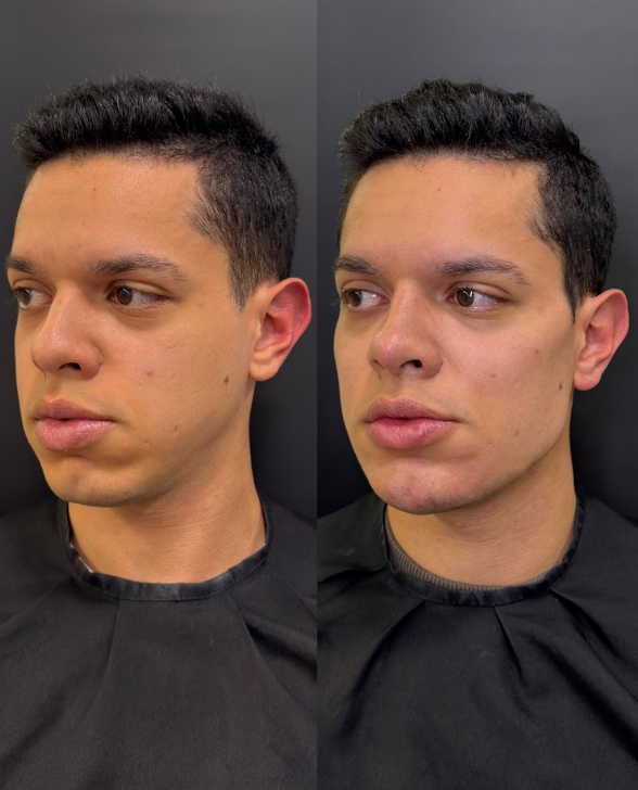 Escultura do ContornoFacial & Pescoço