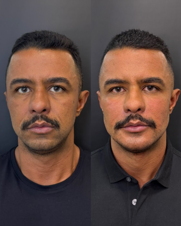 Escultura do ContornoFacial & Pescoço